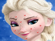 Elsa Fine Makeover